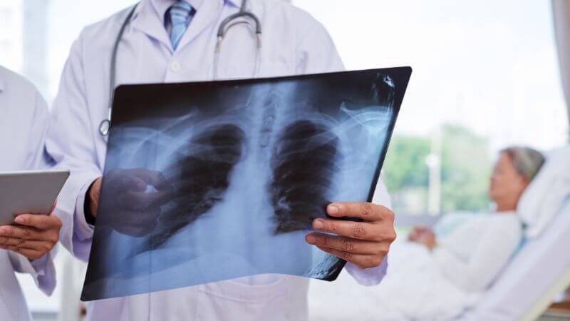 Lung Function Test